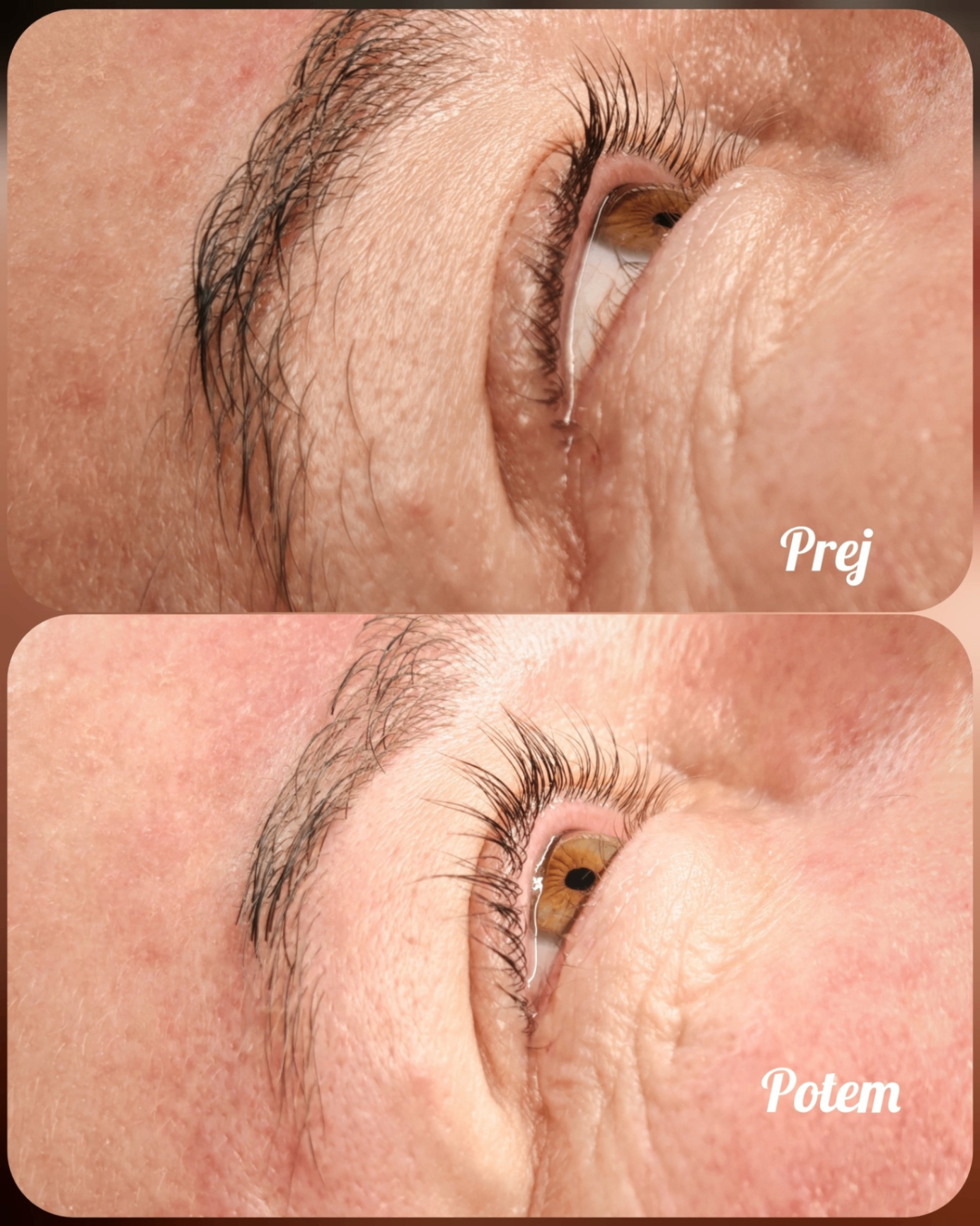 Lash lifting - pred in po
